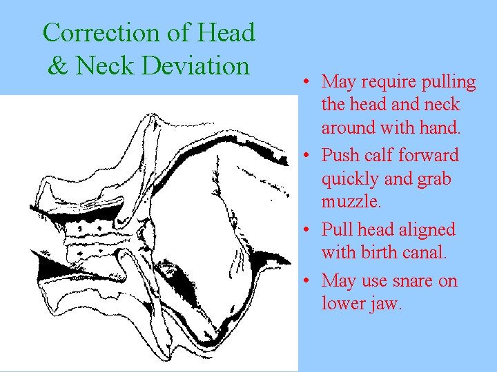 Correction of Head & Neck Deviation • May require pulling the head and neck
