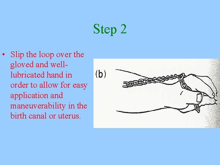 Step 2 • Slip the loop over the gloved and welllubricated hand in order