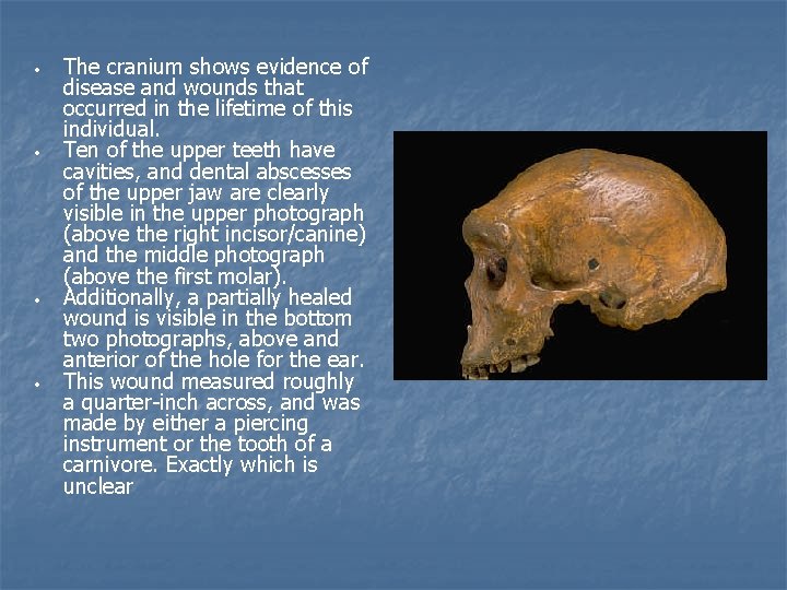  • • The cranium shows evidence of disease and wounds that occurred in