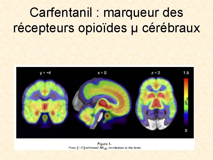 Carfentanil : marqueur des récepteurs opioïdes µ cérébraux 