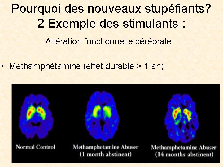 Pourquoi des nouveaux stupéfiants? 2 Exemple des stimulants : Altération fonctionnelle cérébrale • Methamphétamine