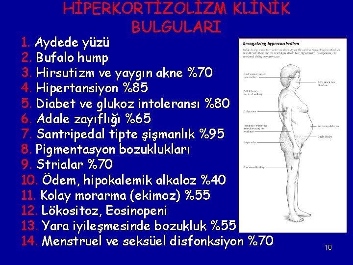 HİPERKORTİZOLİZM KLİNİK BULGULARI 1. Aydede yüzü 2. Bufalo hump 3. Hirsutizm ve yaygın akne