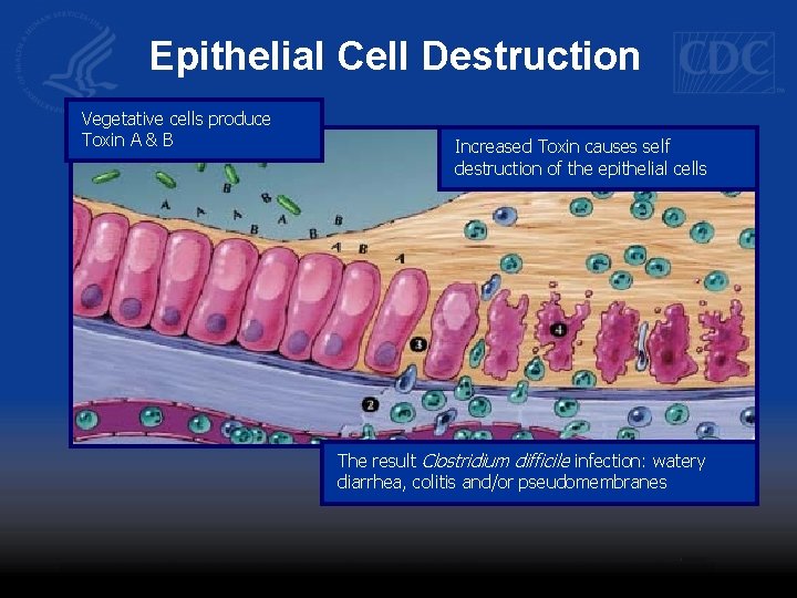 Epithelial Cell Destruction Vegetative cells produce Toxin A & B Increased Toxin causes self