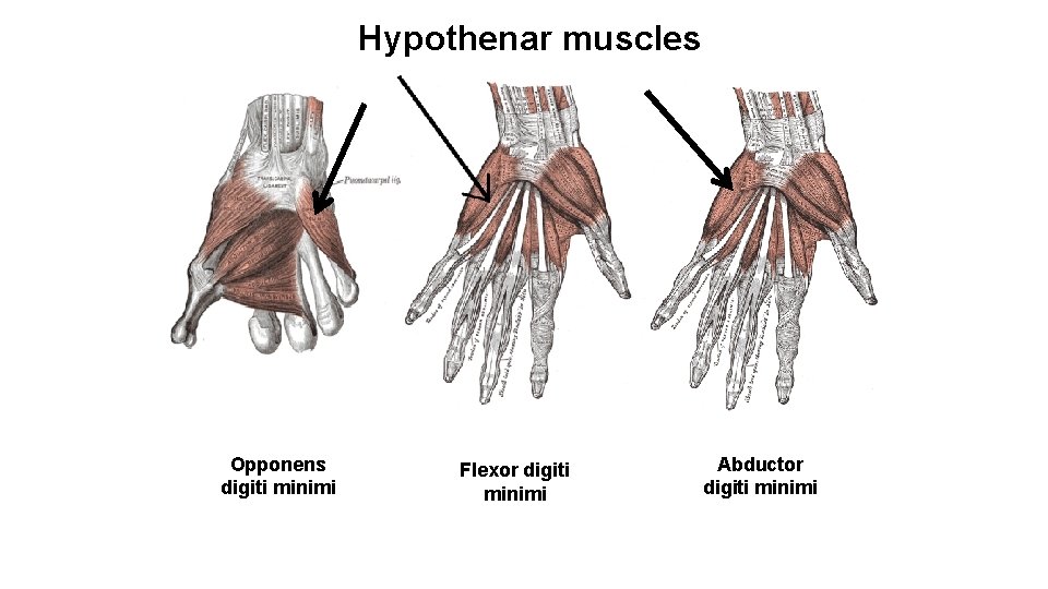 Hypothenar muscles Opponens digiti minimi Flexor digiti minimi Abductor digiti minimi 