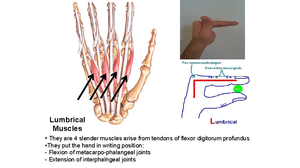 Lumbrical Muscles • They are 4 slender muscles arise from tendons of flexor digitorum