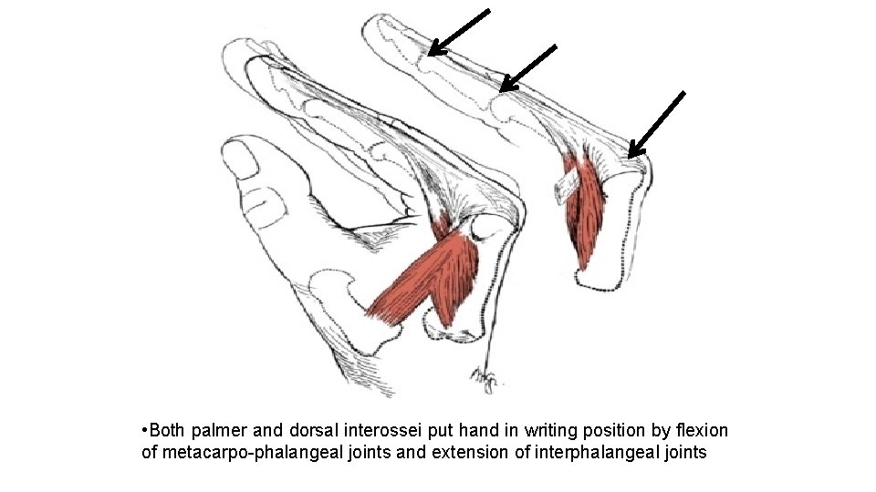  • Both palmer and dorsal interossei put hand in writing position by flexion