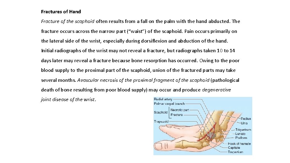 Fractures of Hand Fracture of the scaphoid often results from a fall on the