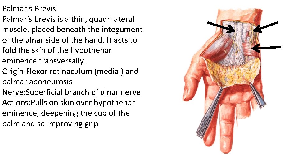 Palmaris Brevis Palmaris brevis is a thin, quadrilateral muscle, placed beneath the integument of