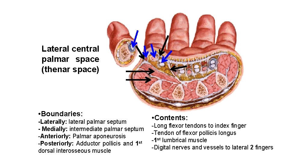 Lateral central palmar space (thenar space) • Boundaries: -Laterally: lateral palmar septum - Medially: