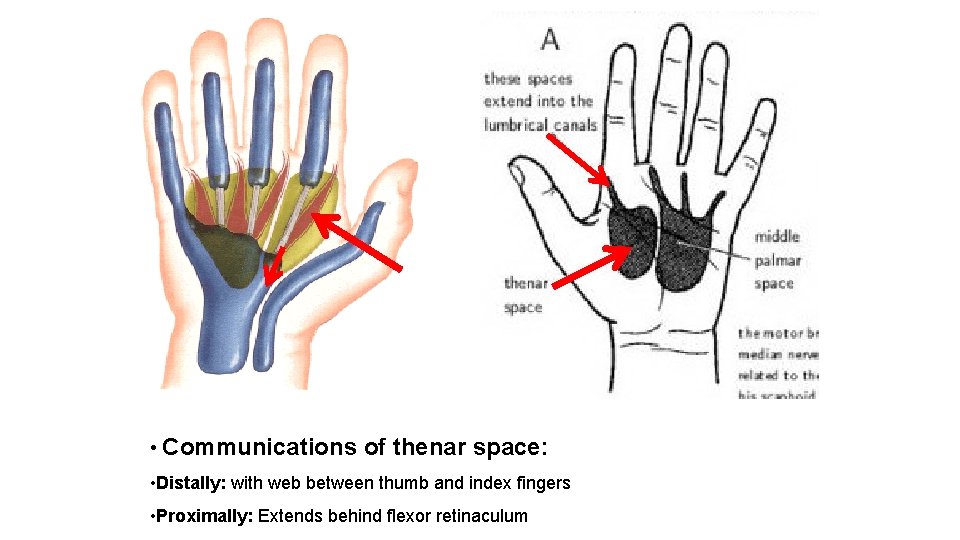  • Communications of thenar space: • Distally: with web between thumb and index
