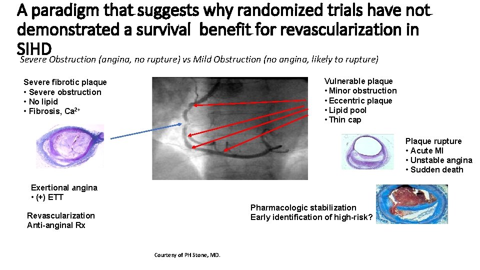 A paradigm that suggests why randomized trials have not demonstrated a survival benefit for