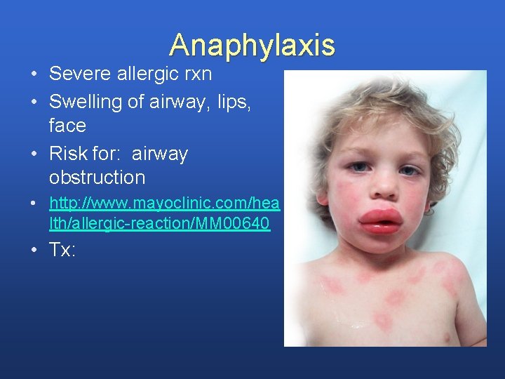 Anaphylaxis • Severe allergic rxn • Swelling of airway, lips, face • Risk for:
