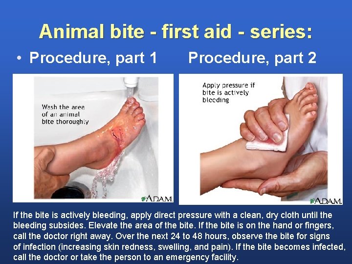 Animal bite - first aid - series: • Procedure, part 1 Procedure, part 2