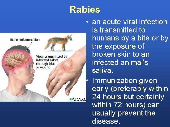 Rabies • an acute viral infection is transmitted to humans by a bite or