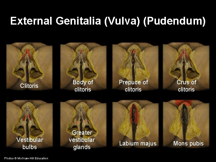 External Genitalia (Vulva) (Pudendum) Clitoris Vestibular bulbs Photos © Mc. Graw-Hill Education Body of