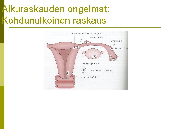 Alkuraskauden ongelmat: Kohdunulkoinen raskaus 