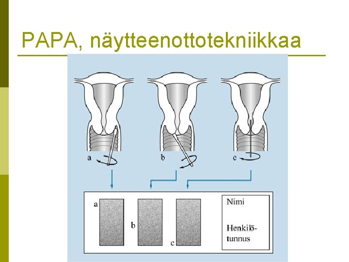 PAPA, näytteenottotekniikkaa 