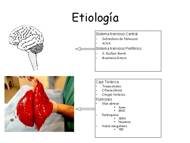 Etiología Sistema Nervioso Central – – Sobredosis de fármacos ACVA Sistema Nervioso Periférico –