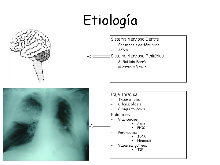 Etiología Sistema Nervioso Central – – Sobredosis de fármacos ACVA Sistema Nervioso Periférico –