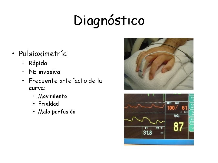 Diagnóstico • Pulsioximetría • Rápida • No invasiva • Frecuente artefacto de la curva: