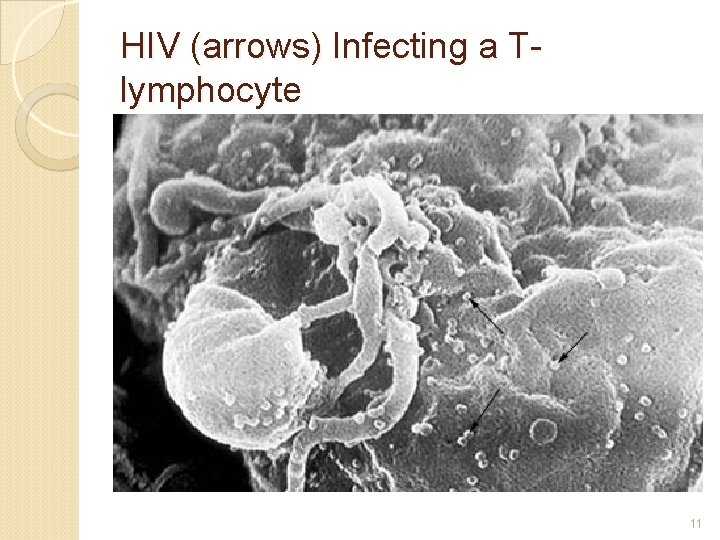 HIV (arrows) Infecting a Tlymphocyte 11 