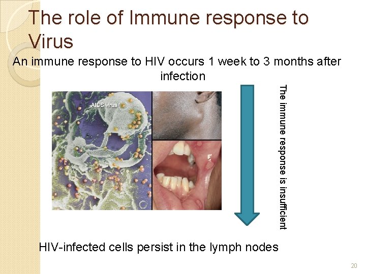 The role of Immune response to Virus An immune response to HIV occurs 1