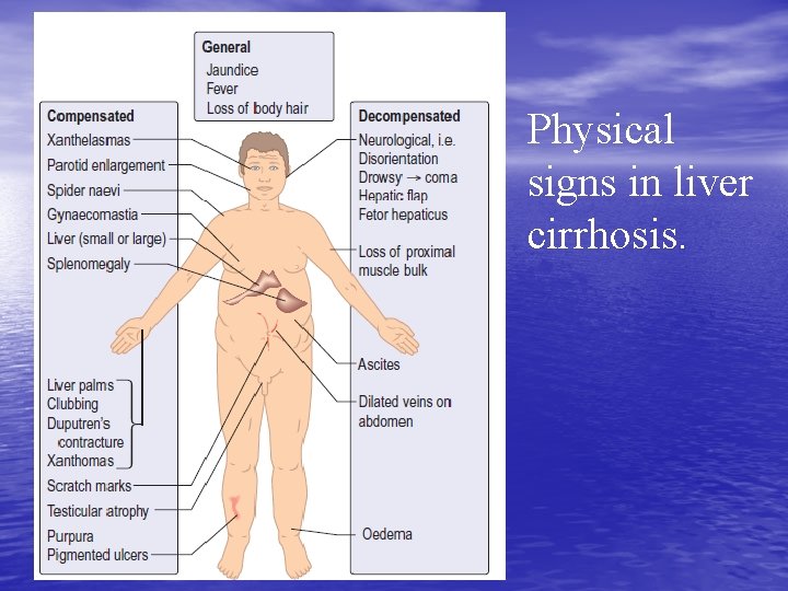 Physical signs in liver cirrhosis. 