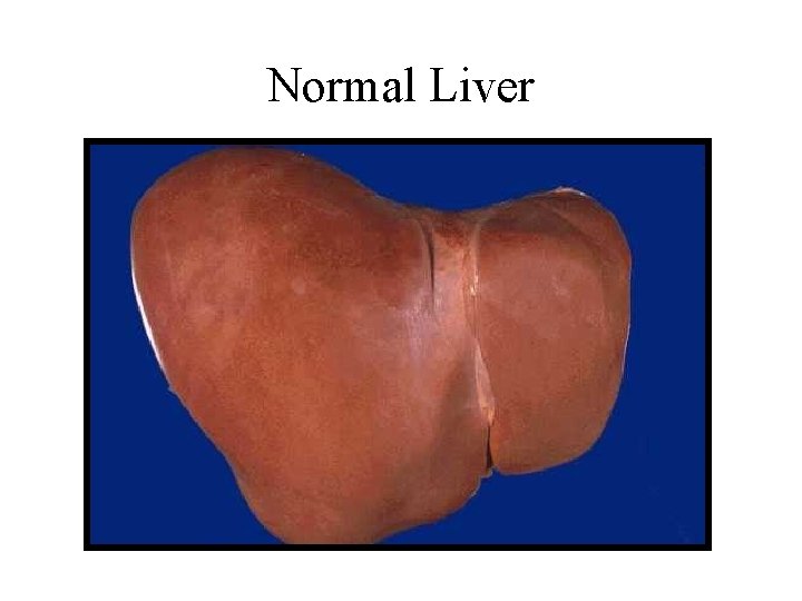 Normal Liver 