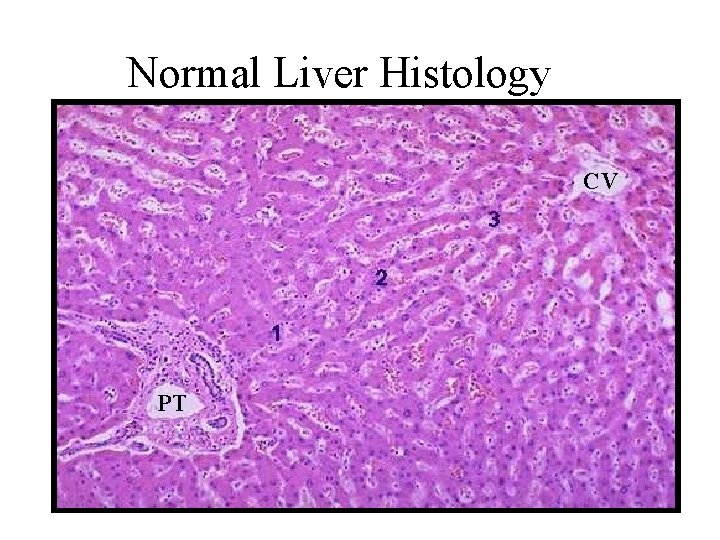 Normal Liver Histology CV PT 
