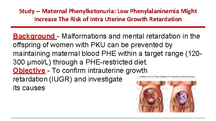 Study -- Maternal Phenylketonuria: Low Phenylalaninemia Might Increase The Risk of Intra Uterine Growth