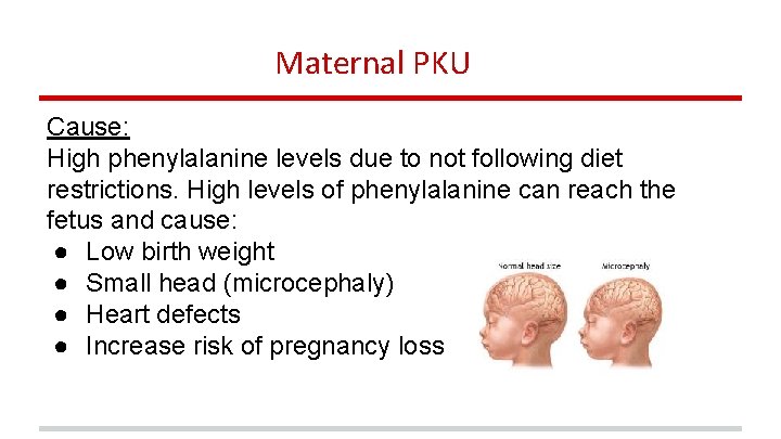 Maternal PKU Cause: High phenylalanine levels due to not following diet restrictions. High levels