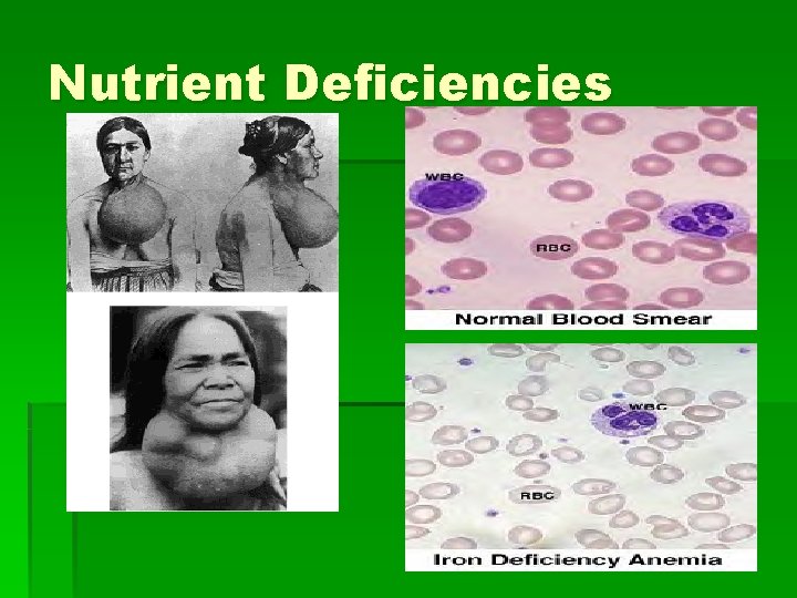 Nutrient Deficiencies 