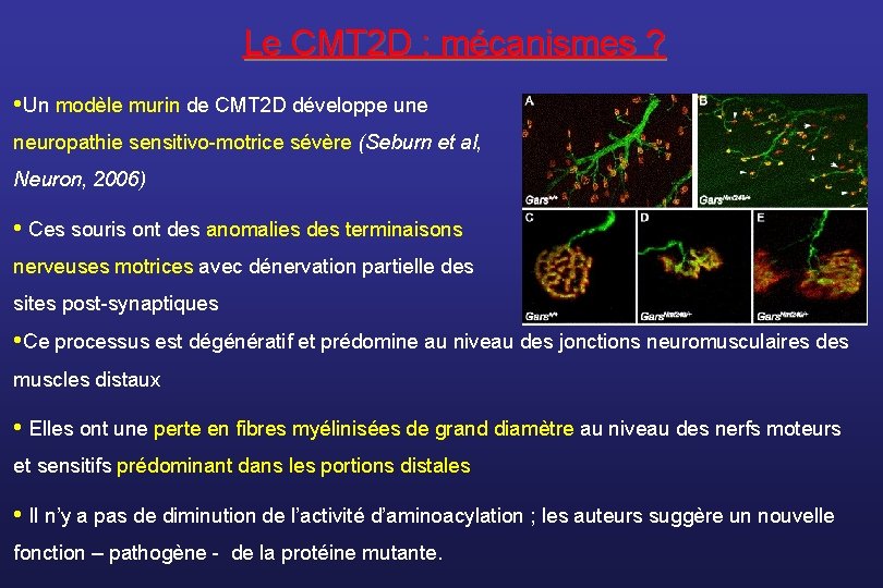 Le CMT 2 D : mécanismes ? • Un modèle murin de CMT 2