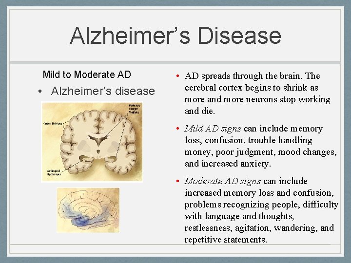 Alzheimer’s Disease Mild to Moderate AD • Alzheimer’s disease • AD spreads through the