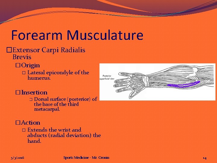 Forearm Musculature �Extensor Carpi Radialis Brevis �Origin � Lateral epicondyle of the humerus. �Insertion