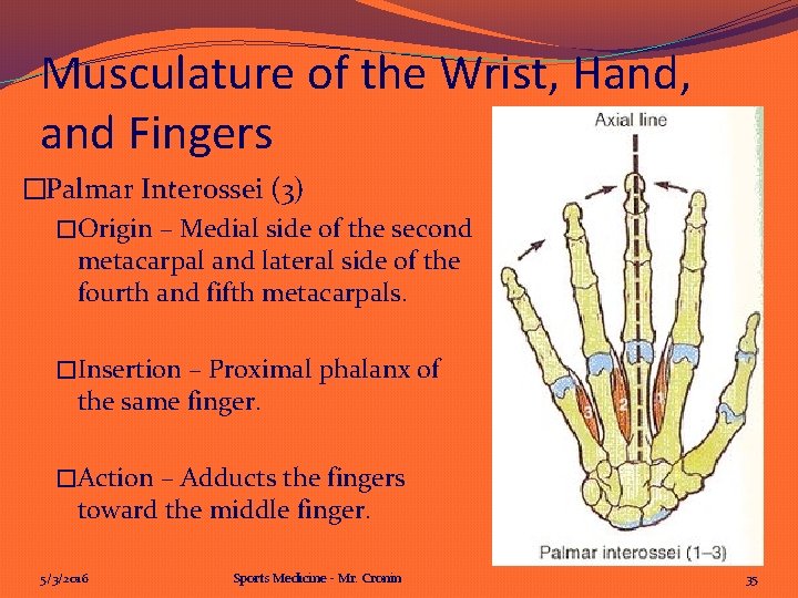 Musculature of the Wrist, Hand, and Fingers �Palmar Interossei (3) �Origin – Medial side