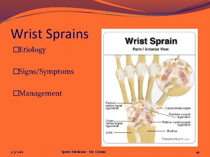 Wrist Sprains �Etiology �Signs/Symptoms �Management 5/3/2016 Sports Medicine - Mr. Cronin 49 