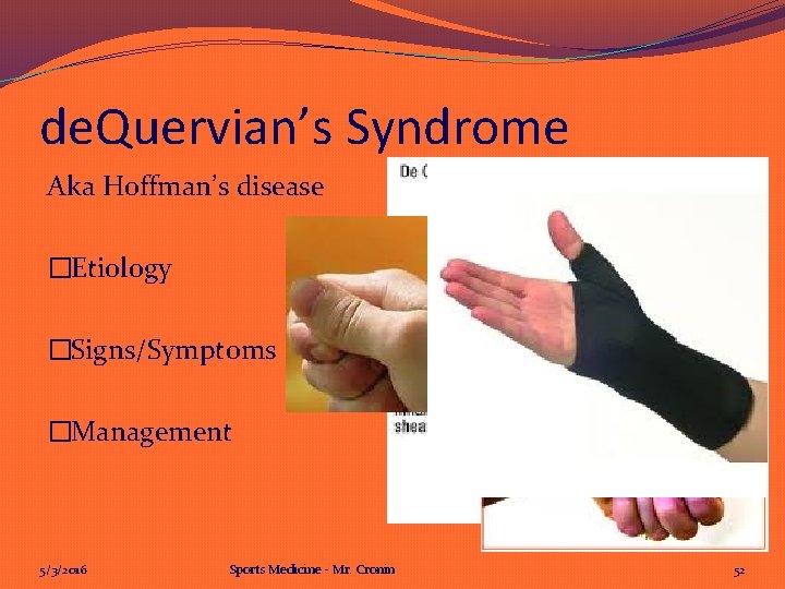 de. Quervian’s Syndrome Aka Hoffman’s disease �Etiology �Signs/Symptoms �Management 5/3/2016 Sports Medicine - Mr.