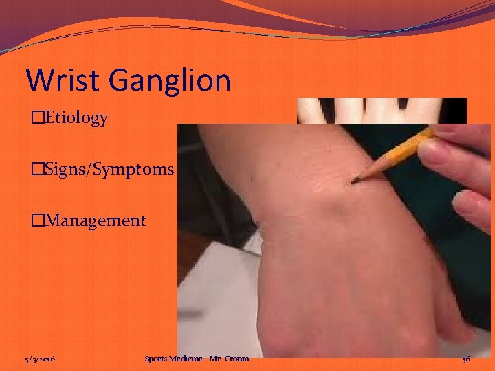 Wrist Ganglion �Etiology �Signs/Symptoms �Management 5/3/2016 Sports Medicine - Mr. Cronin 56 