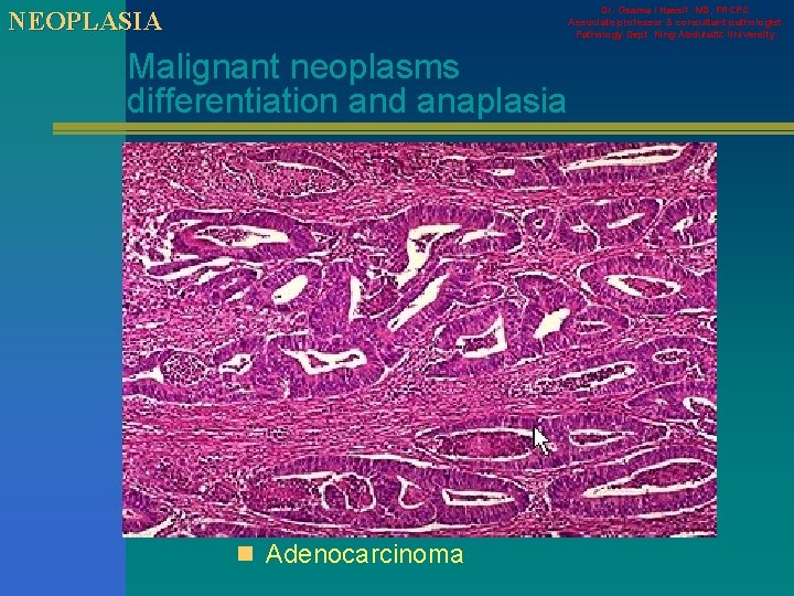 Dr. Osama I Nassif. MD, FRCPC. Associate professor & consultant pathologist. Pathology Dept. King