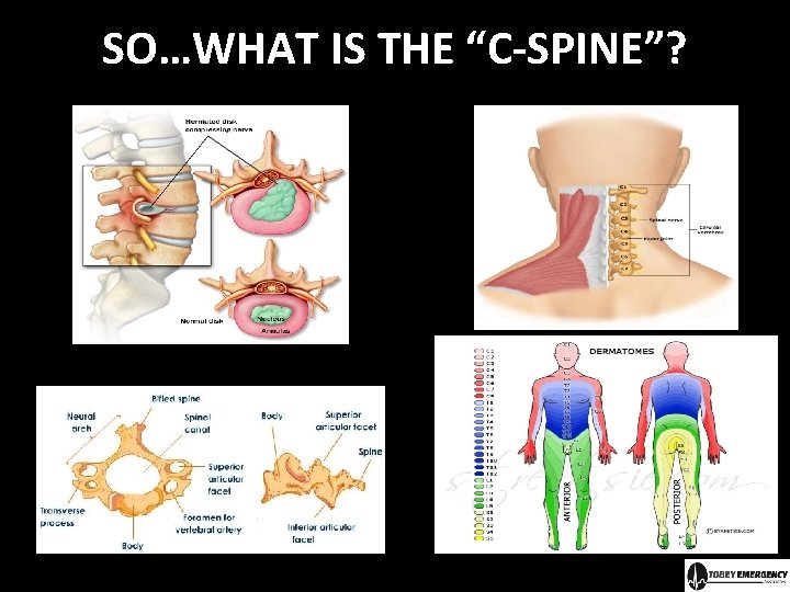 Prehospital Selective Cervical Spinal Clearance Amy Gutman MD