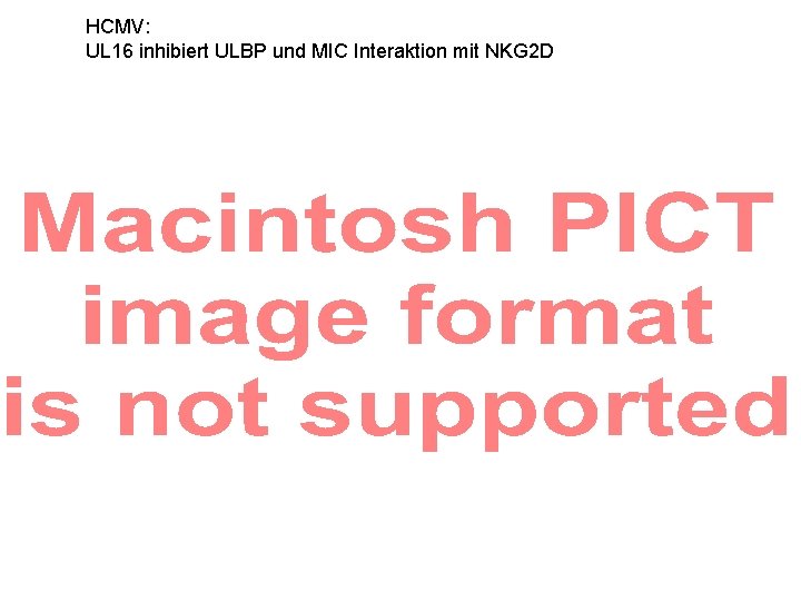 HCMV: UL 16 inhibiert ULBP und MIC Interaktion mit NKG 2 D 