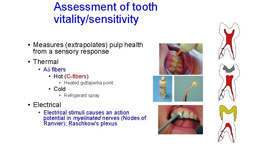 Assessment of tooth vitality/sensitivity • Measures (extrapolates) pulp health from a sensory response •