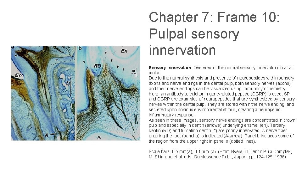 Chapter 7: Frame 10: Pulpal sensory innervation Sensory innervation. Overview of the normal sensory