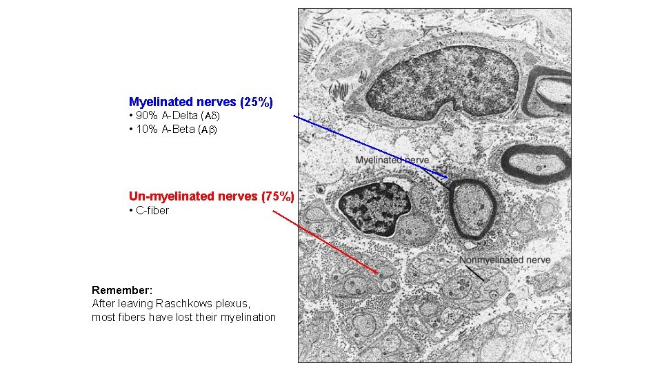 Myelinated nerves (25%) • 90% A-Delta (A ) • 10% A-Beta (A ) Un-myelinated