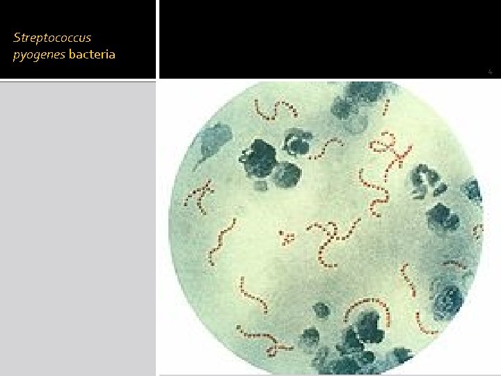 Streptococcus pyogenes bacteria 4 