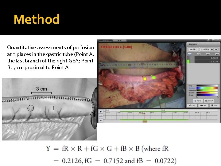 Method Quantitative assessments of perfusion at 2 places in the gastric tube (Point A,