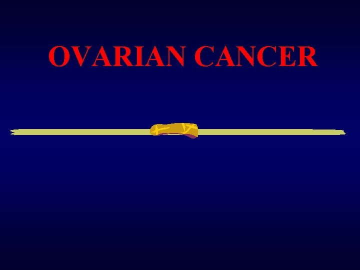 OVARIAN CANCER 