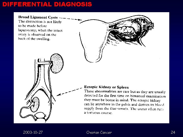 DIFFERENTIAL DIAGNOSIS 2003 -10 -27 Ovarian Cancer 24 