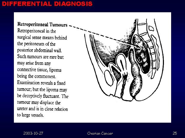 DIFFERENTIAL DIAGNOSIS 2003 -10 -27 Ovarian Cancer 25 